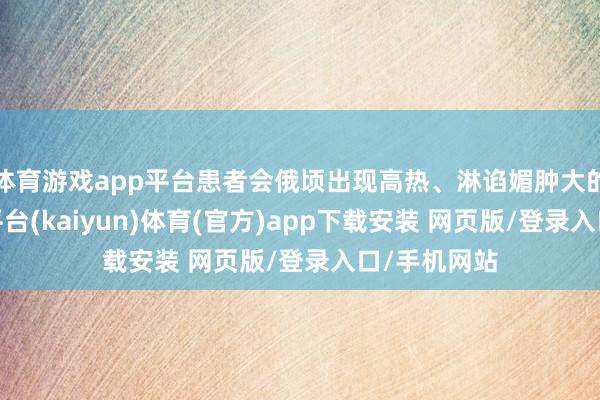 体育游戏app平台患者会俄顷出现高热、淋谄媚肿大的症状-开云平台(kaiyun)体育(官方)app下载安装 网页版/登录入口/手机网站